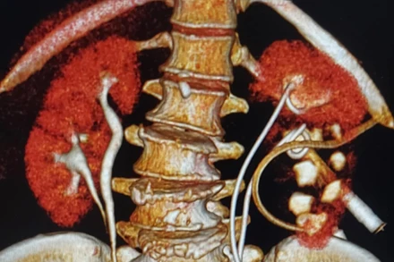 Hình ảnh trên phim chụp của người bệnh.