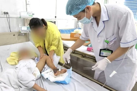 Bác sĩ làm sạch vết thương cho bệnh nhi. 