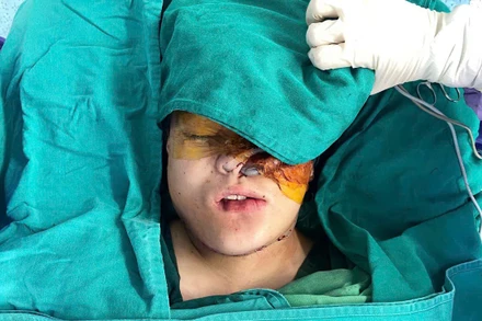 Phẫu thuật tái tạo lại gương mặt cho bệnh nhân.