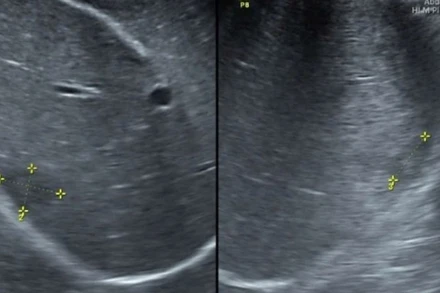 Hình ảnh siêu âm của bệnh nhân. 