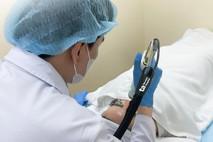 Bác sĩ sử dụng laser 6D điều trị tình trạng giãn mao mạch cho bệnh nhân. 