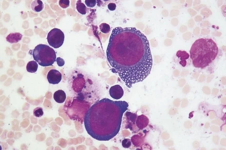 Parvovirus B19 tập trung lây nhiễm ở các tế bào phân chia nhanh, gây độc làm cho tế bào chết nhanh và gây viêm xung quanh. (Ảnh minh họa)