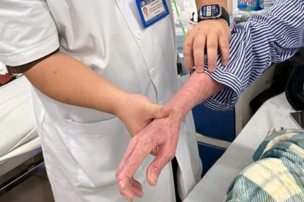 Các tổn thương của người bệnh.