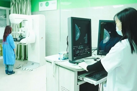 Chụp X-quang vú được coi là "tiêu chuẩn vàng" trong sàng lọc ung thư vú, có khả năng phát hiện các tổn thương nhỏ ngay cả khi chưa sờ thấy được.
