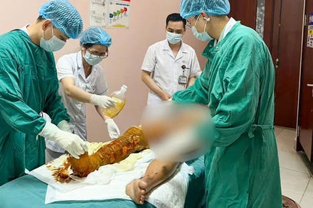 Bệnh nhân nhập viện trong tình trạng bỏng nặng vùng đùi. 