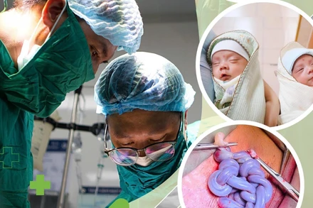 Hai bé gái chào đời ở tuần thai 30 an toàn. 