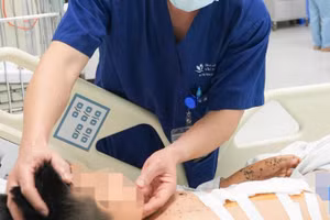 Năm ngày giành giật sự sống cho bệnh nhi 9 tuổi bị tai nạn từ kíp nổ tự chế