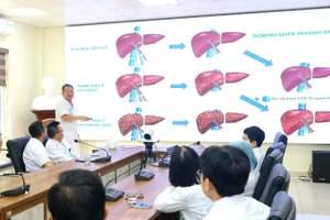 Phó Giáo sư, Tiến sĩ Dương Đức Hùng, Giám đốc Bệnh viện Hữu nghị Việt Đức cùng các bác sĩ hội chẩn trường hợp ghép tạng domino đặc biệt. 