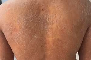 Tình trạng bệnh nhân khi đến khám. 