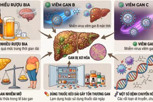 Các nguyên nhân gây bệnh xơ gan. (Ảnh: BVCC)