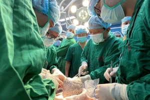 Các thầy thuốc thực hiện ca ghép phổi cuối năm. 