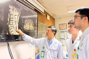 Hình ảnh cộng hưởng từ cho thấy người bệnh bị hẹp ống sống cổ đa tầng (C4-C6).