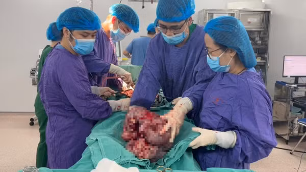 Kíp phẫu thuật xử lý bóc tách khối u.