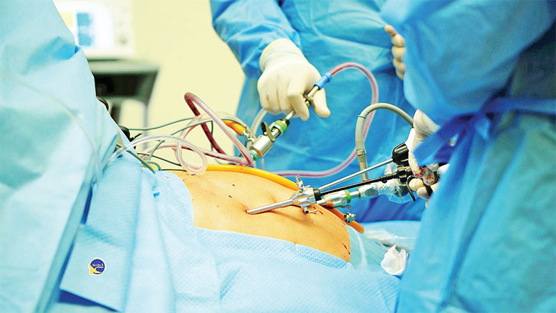 Ê-kíp phẫu thuật nội soi cắt gan đang làm việc. (Ảnh CTV)