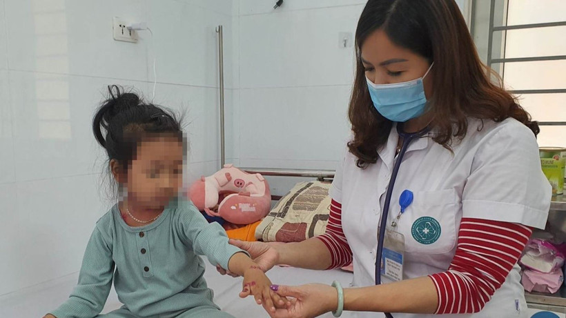 Bác sĩ khám cho bệnh nhi mắc thủy đậu đang nằm viện điều trị. 