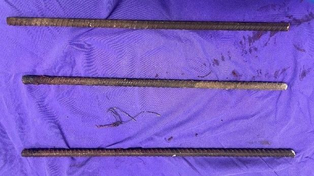 3 cọc sắt được lấy ra từ người bệnh nhân.