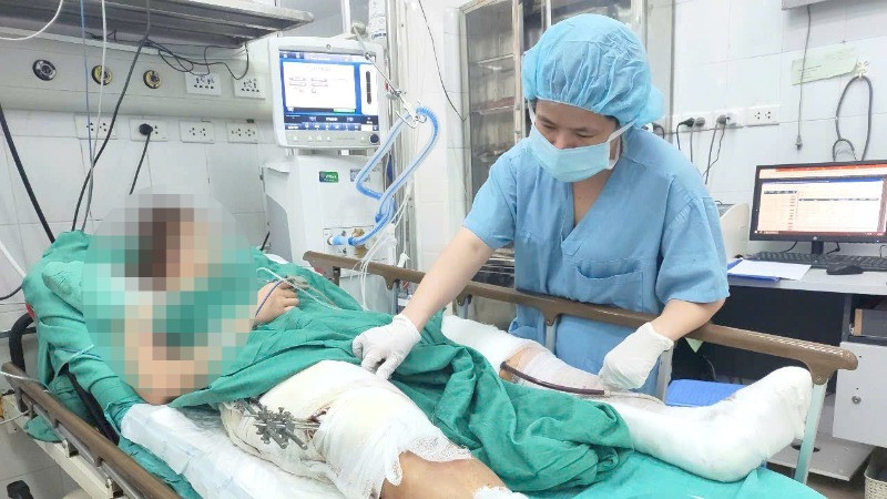 Bệnh nhân Nguyễn Thị N. (32 tuổi; Gia Lộc, Hải Dương) chẩn đoán đa chấn thương, đang được chăm sóc tại khoa Hồi tỉnh 3, Trung tâm Gây mê và Hồi sức Ngoại khoa. 