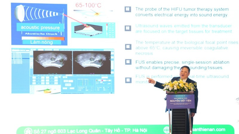 Giáo sư, Tiến sĩ Nguyễn Viết Tiến, nguyên Thứ trưởng Y tế chia sẻ về kỹ thuật mới điều trị khối u. 