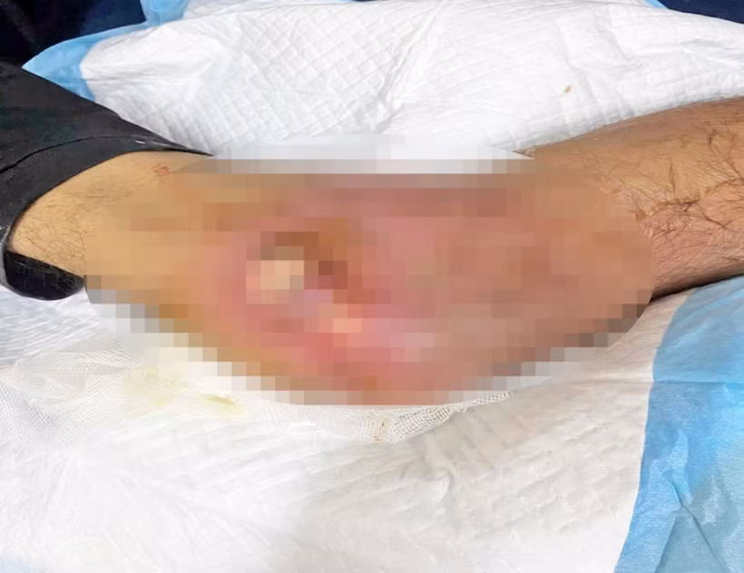 Vết thương của người bệnh.