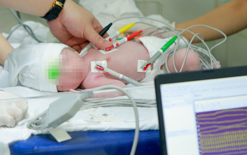 Bệnh nhi được cứu sống kịp thời.