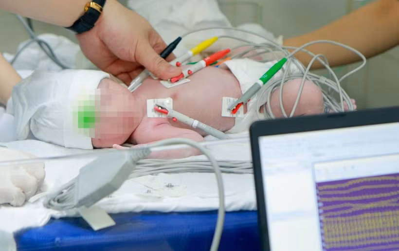 Bệnh nhi được cứu sống kịp thời.