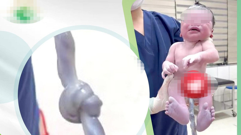 Em bé chào đời an toàn. 