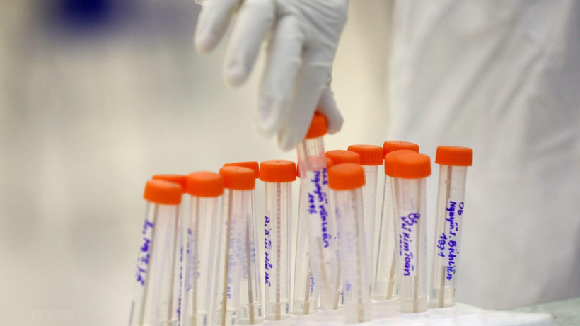 Theo đánh giá của Bộ Y tế, hiện nay tình hình dịch Covid-19 tiếp tục diễn biến phức tạp. (Ảnh: TTXVN/Vietnam+)