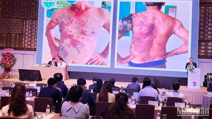 Các chuyên gia trình bày một ca bệnh lý về da với các đại biểu dự hội nghị