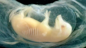 Phôi lợn có tế bào tim người đã sống sót trong 21 ngày. (Nguồn: Science Photo)