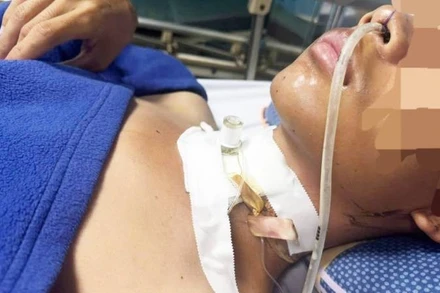 Sau phẫu thuật, sức khỏe của bệnh nhân đang dần ổn định.