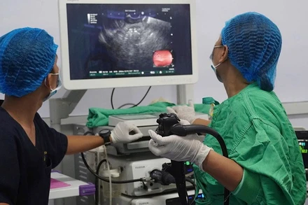 Ê-kíp nội soi đặt stent LAMS cho bệnh nhân. 