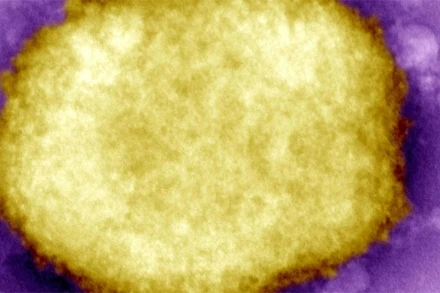 Một loại virus đậu mùa khỉ. (Ảnh: Thời báo Hà Lan)