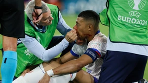 [Ảnh] Gặp chấn thương mũi, Kylian Mbappé để ngỏ khả năng ra sân trận tiếp theo