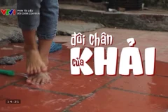 Bộ phim tài liệu Khal’s Walk (Đôi chân của Khải) do Hồng Hạnh sản xuất và đạo diễn đã giành giải Nhất, hạng mục Professional Non-Fiction (Phim phi hư cấu - Chuyên nghiệp).