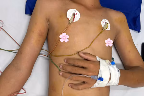 Bệnh nhi H. đã qua cơn nguy kịch và đang được tiếp tục chăm sóc, theo dõi tại Bệnh viện Sản-Nhi Cà Mau. (Ảnh do người nhà bệnh nhi cung cấp).