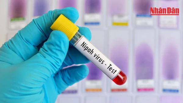 Cần hiểu đúng bản chất dịch bệnh và tuân thủ khuyến cáo y tế.