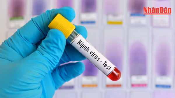 Cần hiểu đúng bản chất dịch bệnh và tuân thủ khuyến cáo y tế.