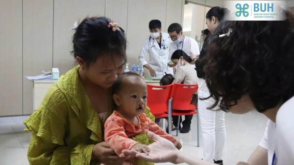 Trẻ em bị dị tật khe hở môi-vòm miệng tham gia chương trình phẫu thuật nụ cười cho trẻ em do Sở Y tế tỉnh Đắk Lắk phối hợp Tổ chức Operation Smile Việt Nam triển khai năm 2023 tại Bệnh viện Đại học Y Dược Buôn Ma Thuột.