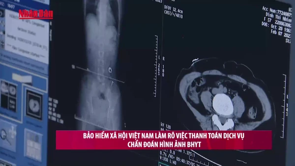 [Video] Bảo hiểm xã hội Việt Nam làm rõ việc thanh toán dịch vụ chẩn đoán hình ảnh BHYT