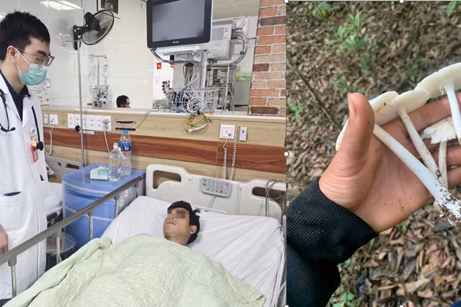 Các nạn nhân ăn nấm độc cấp cứu tại Trung tâm Chống độc, Bệnh viện Bạch Mai.