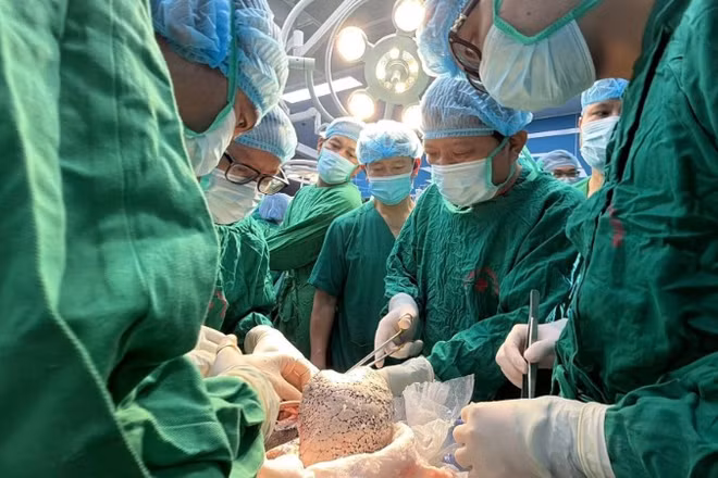 Các thầy thuốc thực hiện ca ghép phổi cuối năm. 