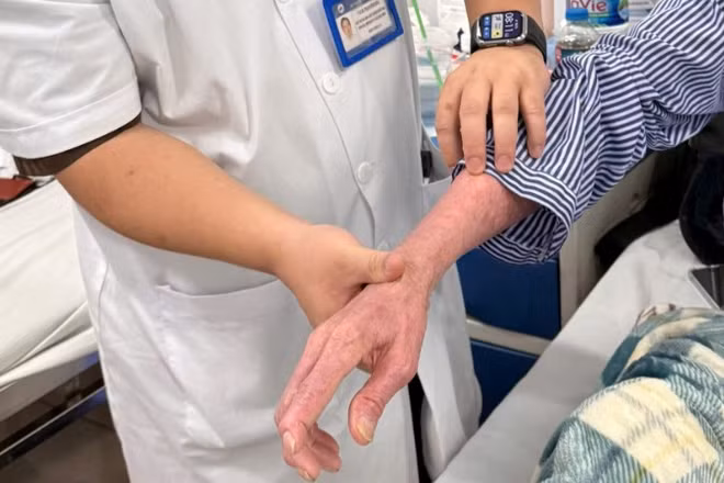 Các tổn thương của người bệnh.