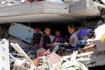 Nhiều trẻ em ở Dải Gaza suy dinh dưỡng nghiêm trọng. (Ảnh TÂN HOA XÃ) 
