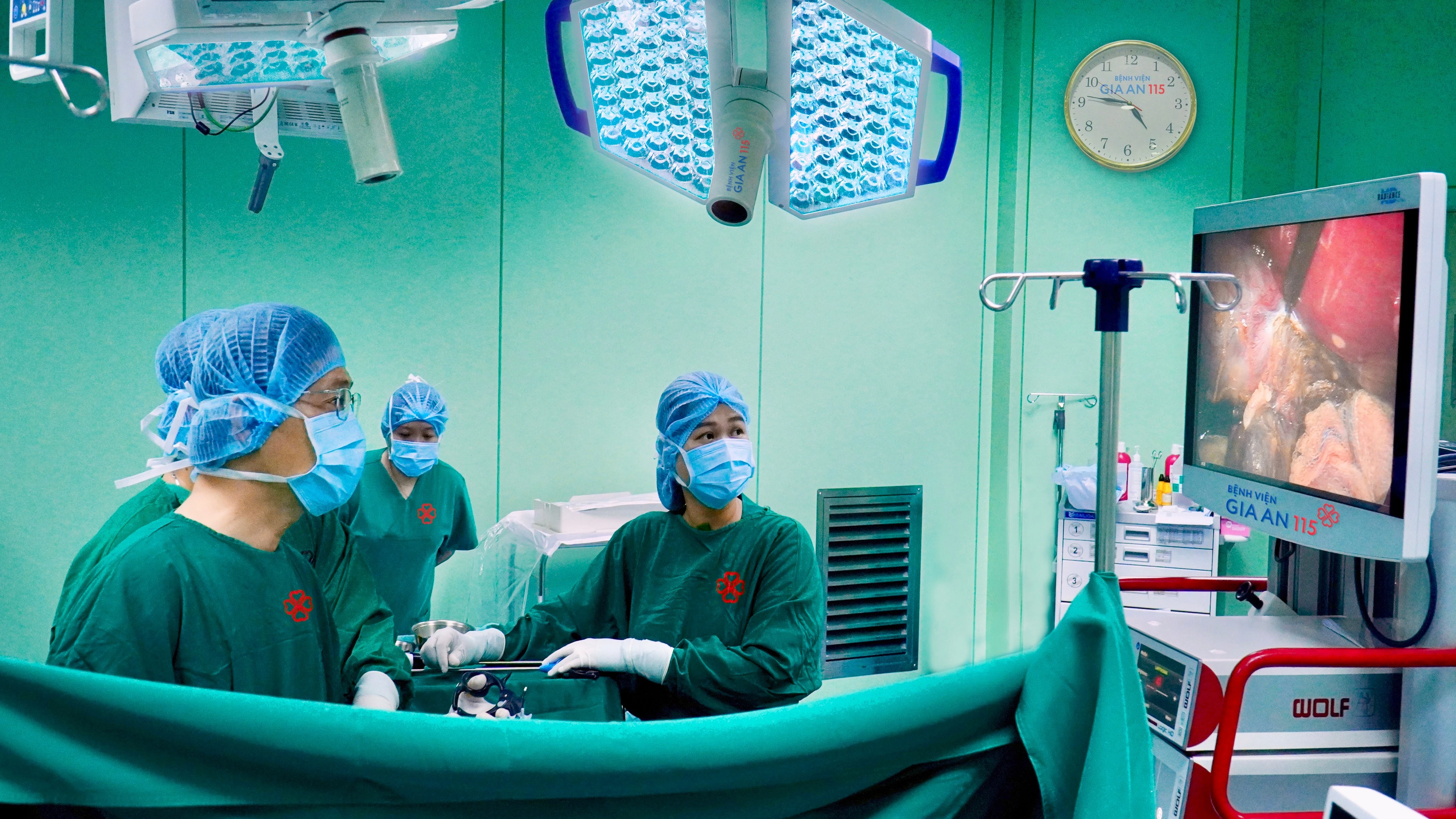 Bệnh nhân phát hiện sỏi túi mật khổng lồ không triệu chứng nhờ siêu âm