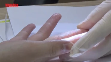 [Video] Cảnh báo gia tăng các bệnh về da trong mùa mưa