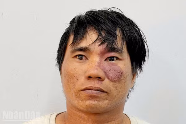 Bị can Lê Công Bằng.