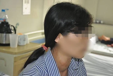 Bệnh nhân đang được điều trị tại Bệnh viện Nội tiết Trung ương.