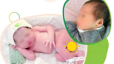 Bé gái chào đời nặng 2.150g.