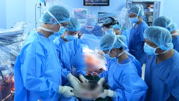 Các bác sĩ tiến hành ca ghép tim cho người bệnh.