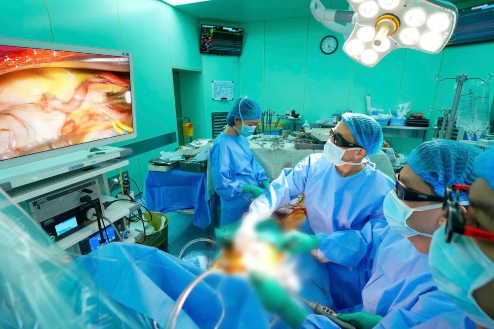Ê-kíp thực hiện phẫu thuật nội soi 3D.